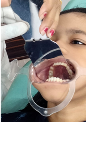 Close-up Dental Examination